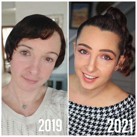 <strong>10 months</strong> and 26 days on E. . 10 months hrt mtf reddit